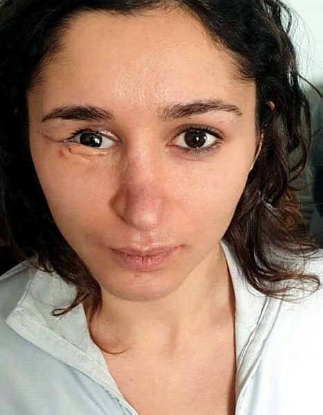 İzmir’de Tuğçe’nin yüzünün parçalandığı tüfekli saldırı davası ağır cezada