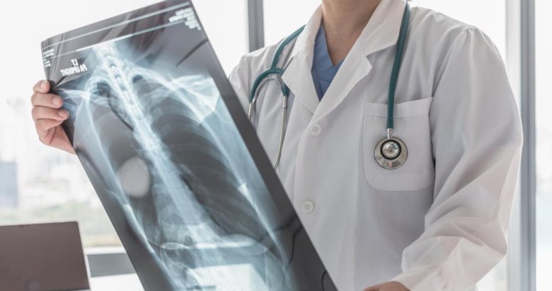 ABD’de rekor seviyede verem salgını