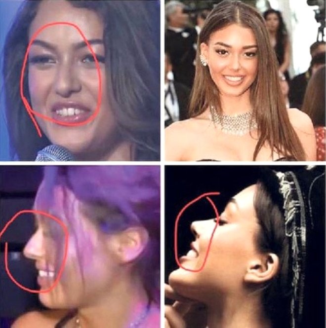 iste unlulerin estetiksiz halleri galeri yeni asir