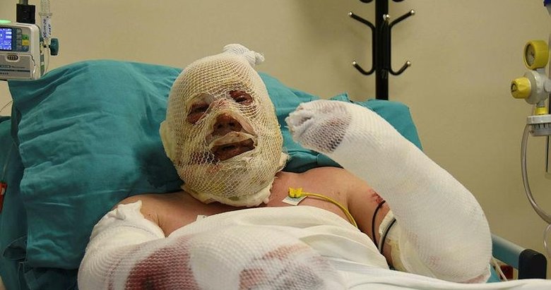 Yangınla savaşırken alevler arasında kaldı! Yaşadığı dehşet anlarını böyle anlattı