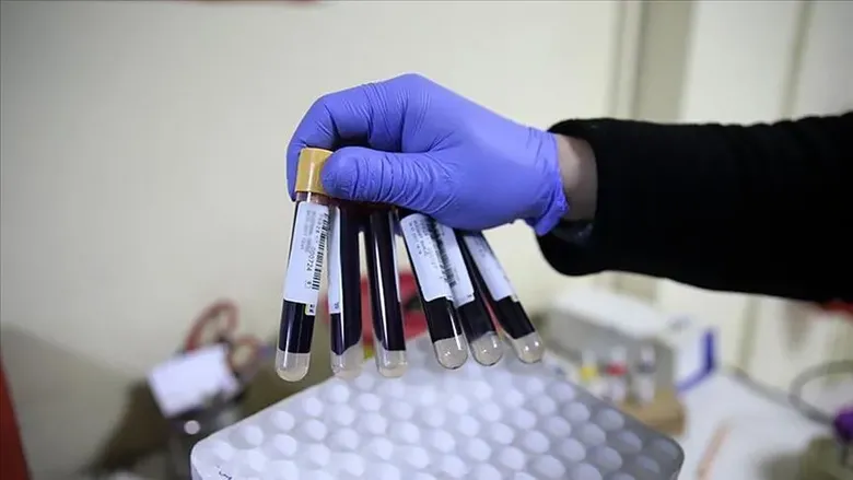 ferritin-nasil-yukseltilir-demir-eksikligi-neden-olur-demir-eksikligine-ne-iyi-gelir-1791962150774.png