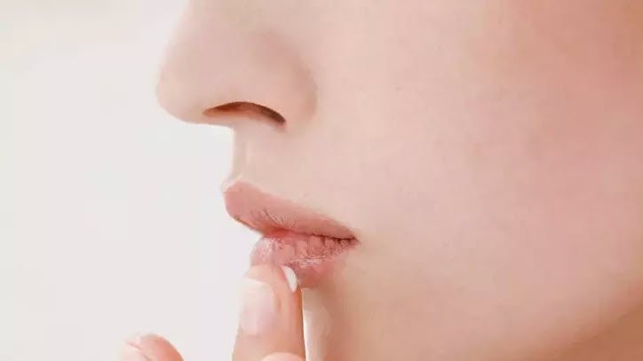 Dudaktaki uçuk en hızlı nasıl geçer? İşte püf noktaları