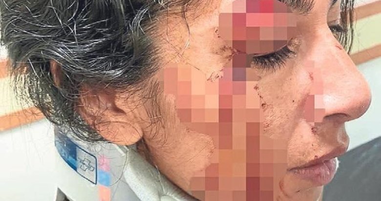 Bodrum’da kadınlar kapıştı