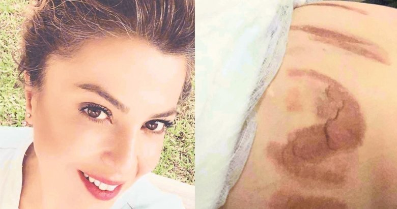 Estetik Merkezinde Skandal Hem Yaktilar Hem De Iftira Attilar Izmir Haberleri