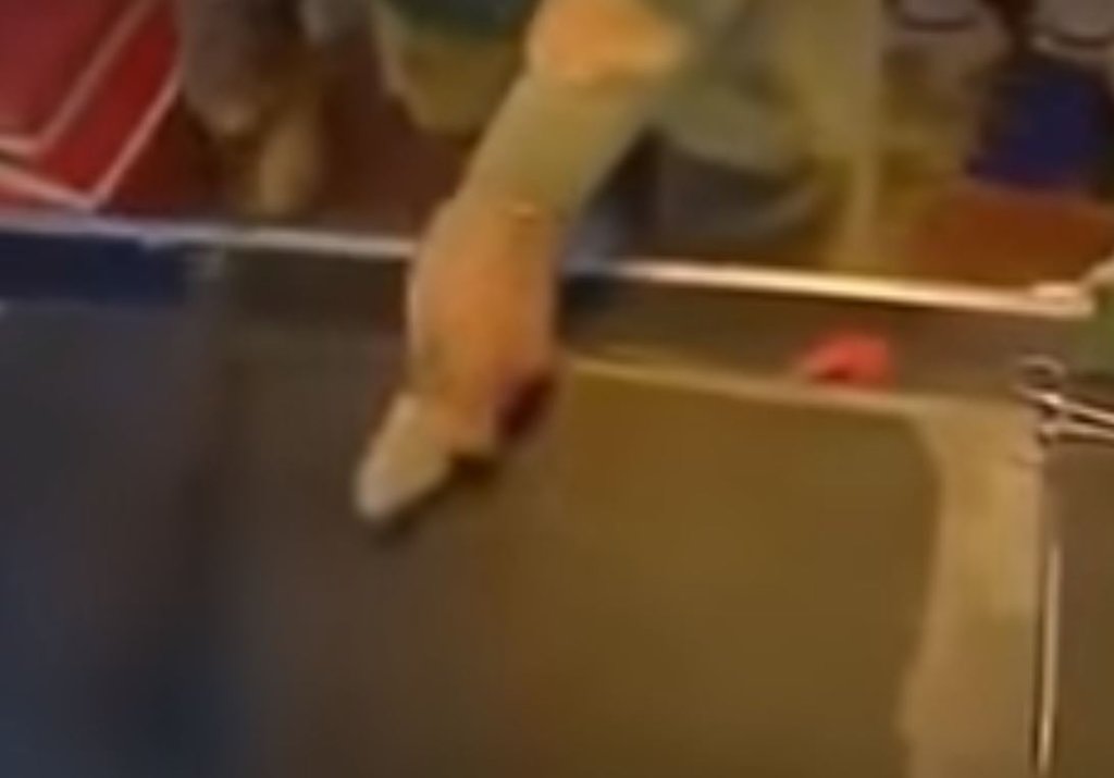 Yılan zehri kanı bakın ne hale getirdi! Görenler dehşete düştü