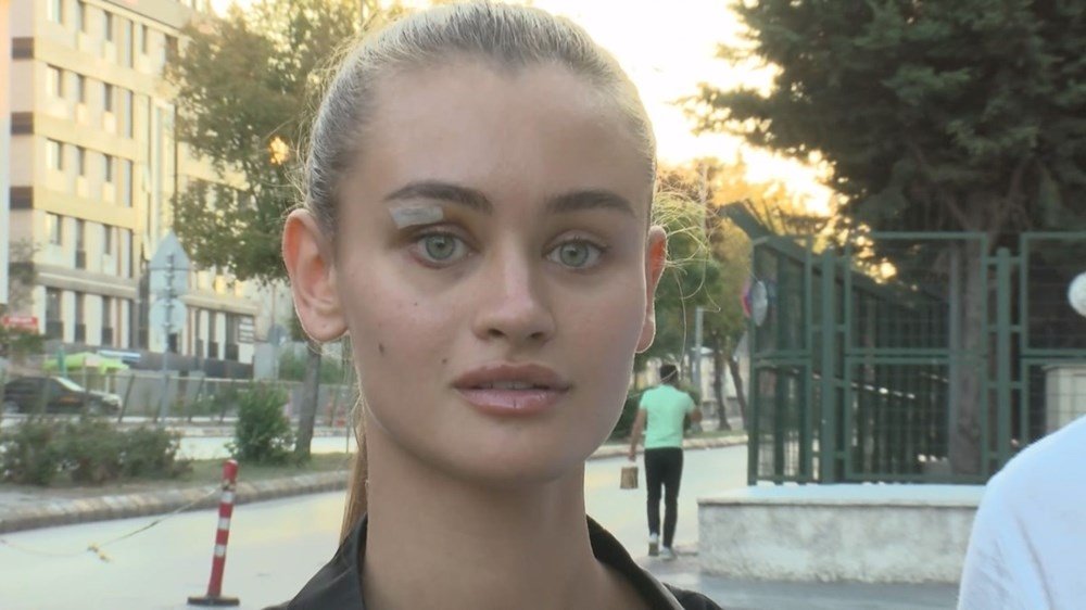 Çeşme’de darp edildiğini iddia eden Ukraynalı model Daria Kyryliuk ifade verdi: Bir daha modellik yapamayacağım sandım