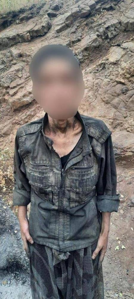 PKK’lı teröristler sefalet içinde: Açlıktan bağırsakları delinmiş