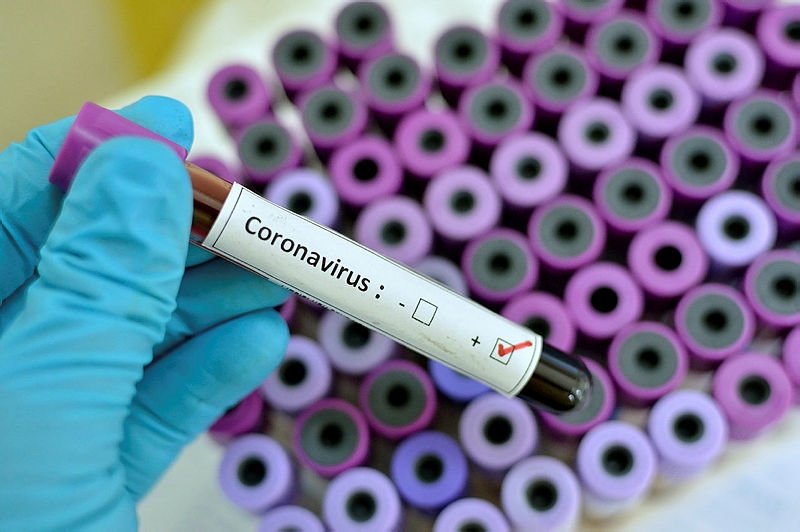 Dünyayı alarma geçiren koronavirüs nedir? Koronavirüs belirtileri neler? Nasıl korunulur? İşte 20 soruda koronavirüs salgını