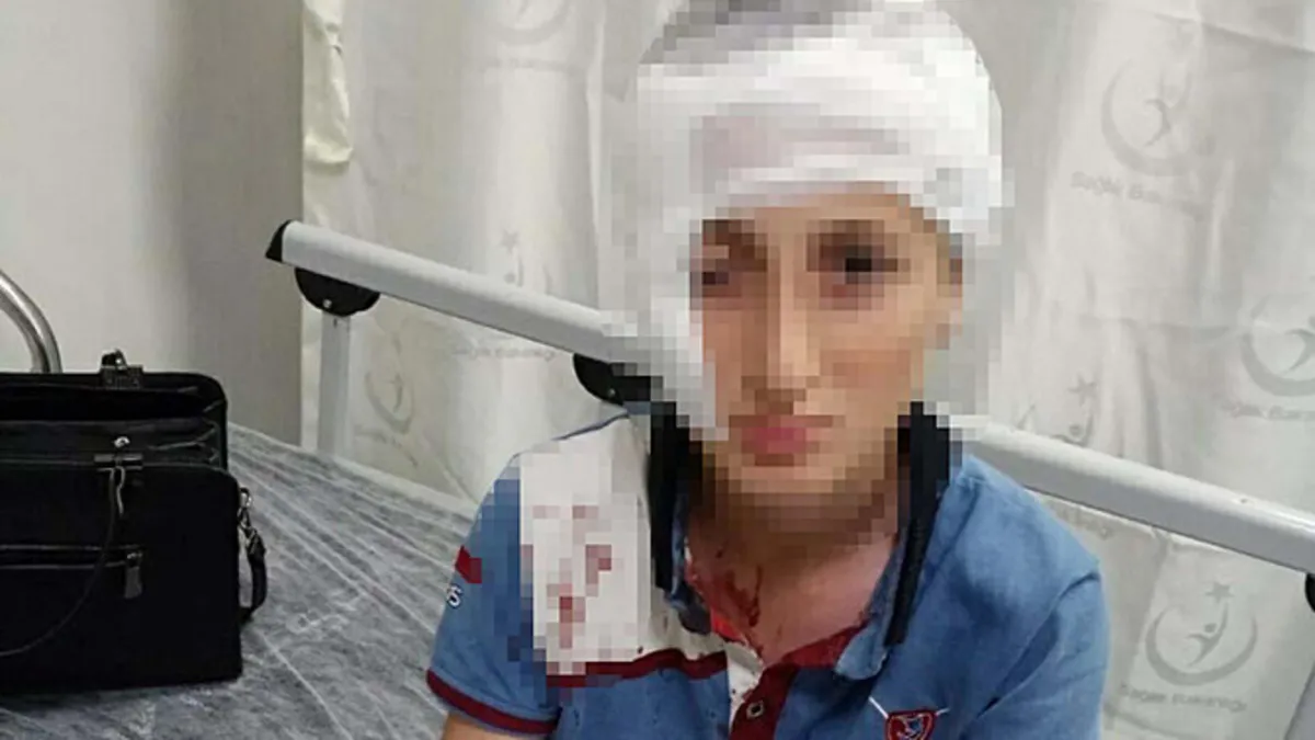 11 yaşında köpek saldırısına uğradı, yüzünde iz kaldı: İzmir’de 1,2 milyon TL’lik karar