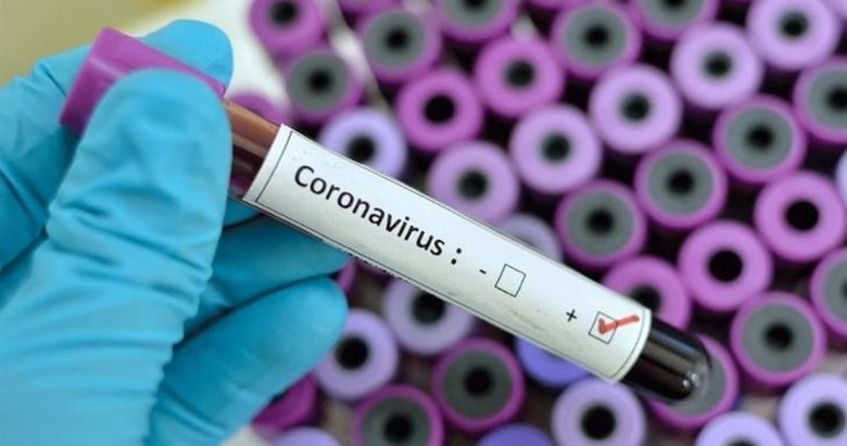 Bilim Kurulu Üyesi Alpay Azap’tan koronavirüs testleri ile ilgili açıklama