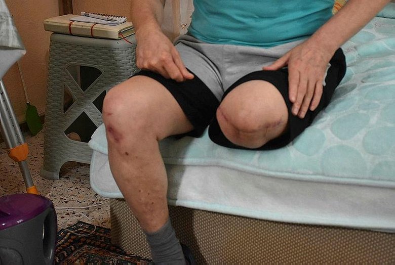 İzmir’de yaşayan adam cam kesiğini önemsemedi bacağından oldu!