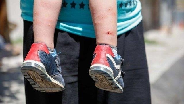 İzmir'de sivrisinek alarmı: Uzmanlar özellikle bu türe karşı hamileleri uyardı