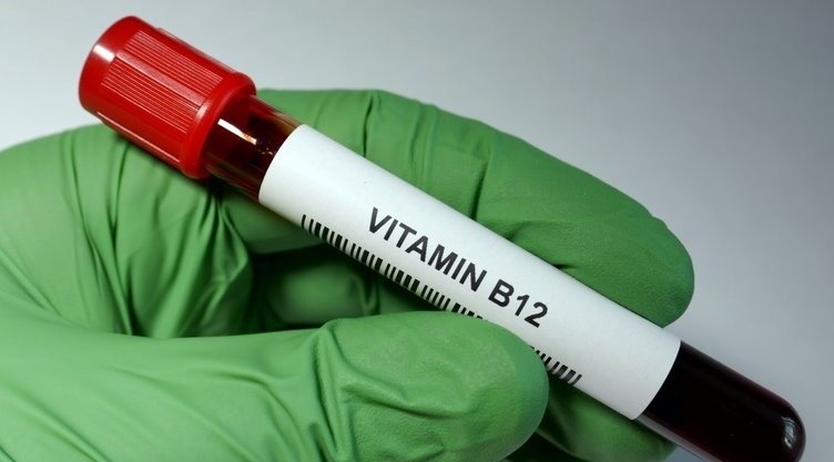 B12 vitamin eksikliği belirtileri nelerdir? B12 vitamini bulunan besinler nelerdir?