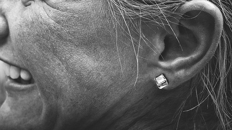 Uzman isimden uyarı: Tek kulakta çınlama varsa aman dikkat: Hastalık belirtisi olabilir