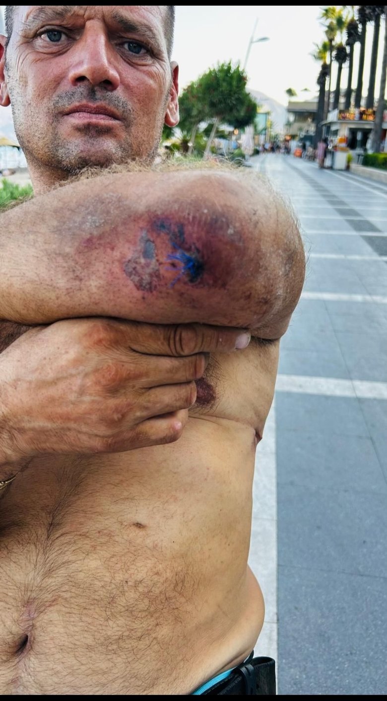Dokuz canlı lakaplı adam sekizinci kazadan da sağ çıktı