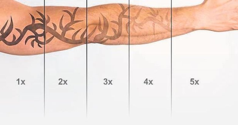 Dövme yaptırırken iki kez düşünün