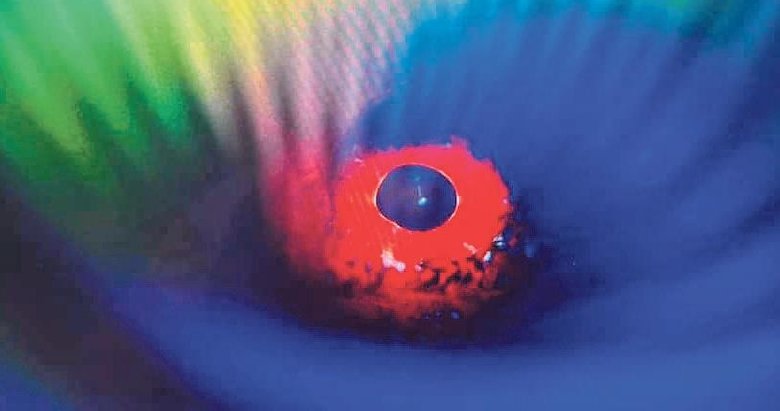 Doktorun iskorpit gözü dünya şampiyonu oldu