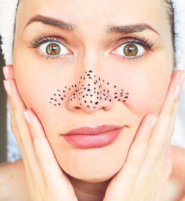 Siyah noktalara karsı fiddy metodu