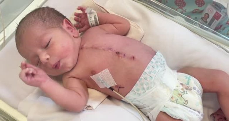 Nefes alamayan Aras bebeğin 4 toplardamarı operasyonla kalbine bağlandı