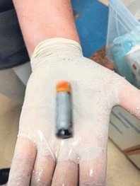 Pili bu kez çocuklar değil yetişkin bir kişi yuttu