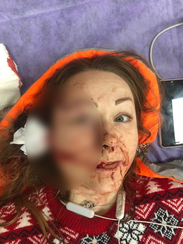 Falçatalı saldırıya uğrayan Anna Butim yaşadıklarını anlattı