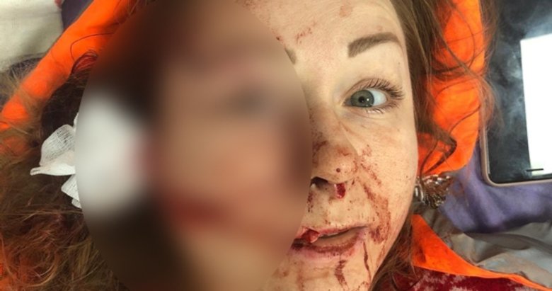 Falçatalı saldırıya uğrayan Anna Butim yaşadıklarını anlattı