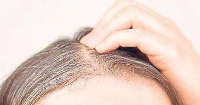 Beyaz saçlara doğal çözüm