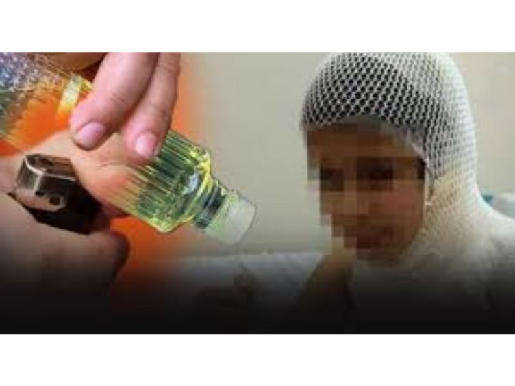 İzmir’de TikTok’taki kolonya akımı 10 yaşındaki Mert’i canından etti!