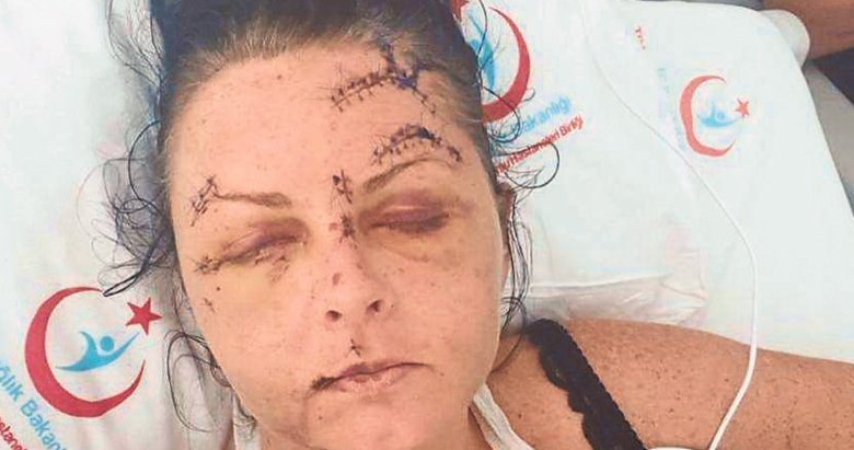 Dünya basını saldırıyı Yeni Asır’dan öğrendi