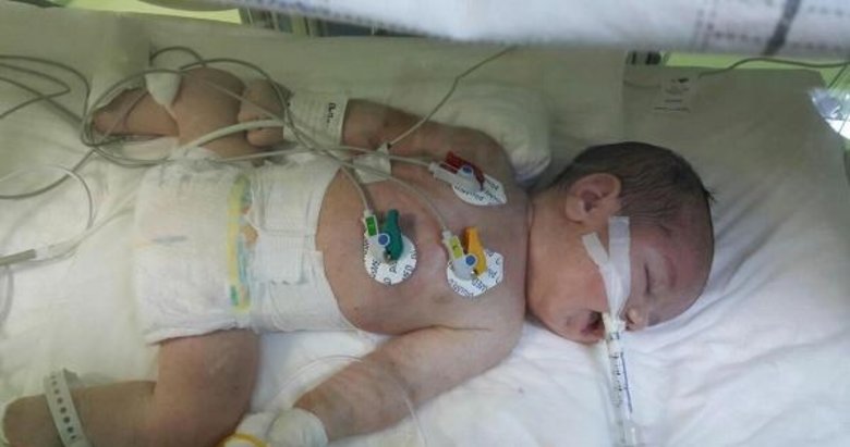 İzmir’deki doğumda korkunç iddia! Hemşire bebeğin kafasını rahme geri itti