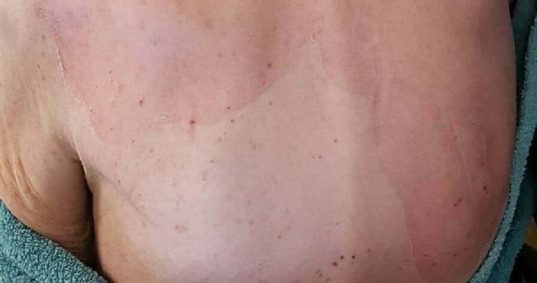 İzmir’de yaşlı bakımevindeki banyo sonrası hayatını kaybetmişti! Açılan davada yeni gelişme yaşandı