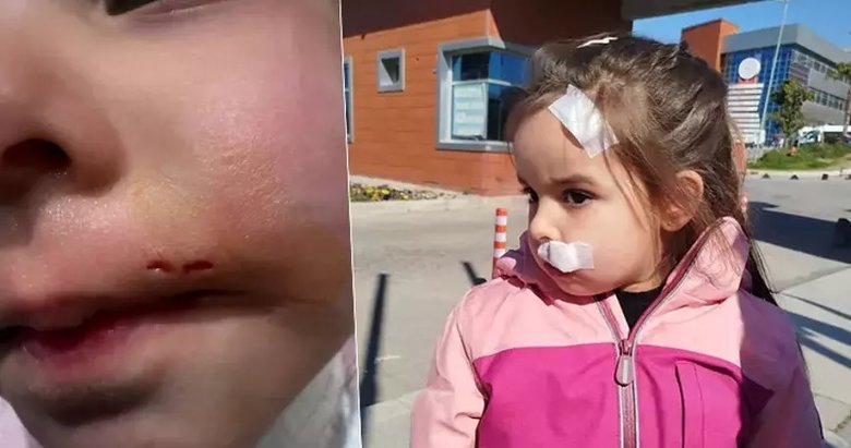 İzmir’de AVM’deki sahipsiz köpek 3 yaşındaki Elif’e saldırdı, dudağını ısırdı