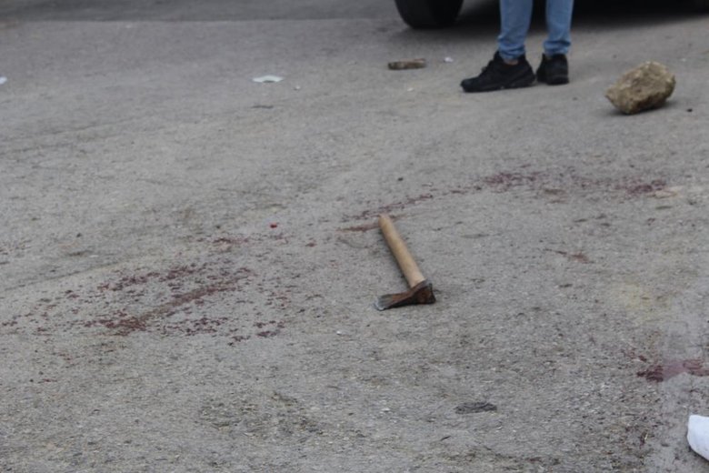 İzmir’de polise baltayla saldıran kişi etkisiz hale getirildi