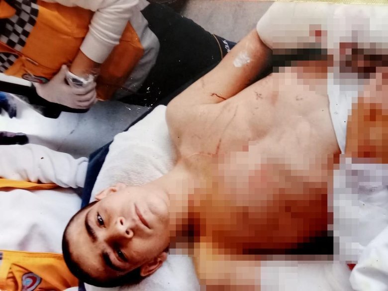 İzmir’de pitbull saldırısına uğrayan Soner, yaşadığı travmayı atlatamadı