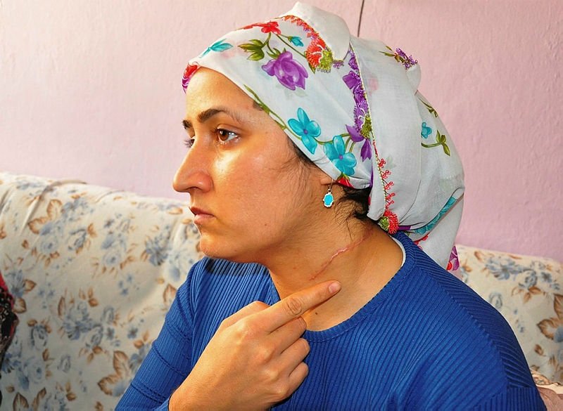 Eşi yaralama davasında hakimden ’Taliban mahkemesi’ çıkışı