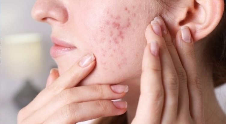 Her gün kola içtiğimizde oluşan etkileri: Fazla kola içmek zararlı mı?