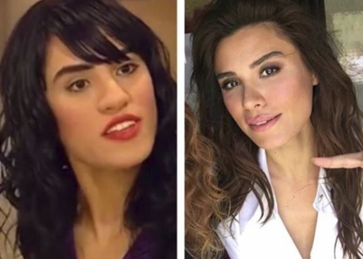 fahriye evcen in estetiksiz hali saskina cevirdi