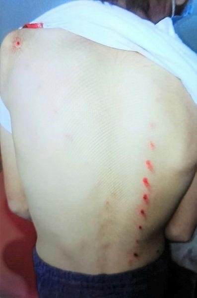 10 yaşındaki çocuğu tırmıkla yaraladı