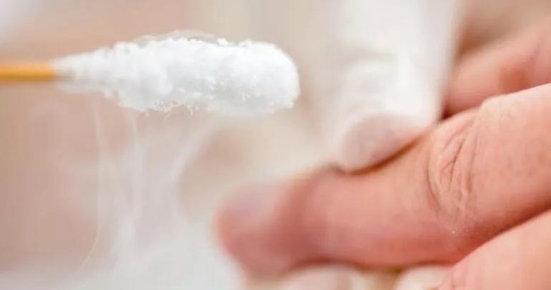 Siğil nasıl geçer? Evde siğil tedavisi nasıl olur?