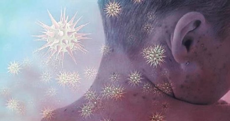 Kızamık Amerika kıtasında yayılıyor