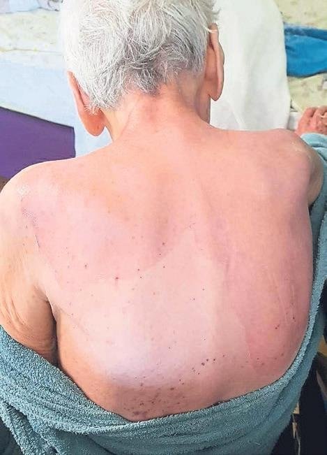 Fatma nineyi kaynar suyla yakmışlar!