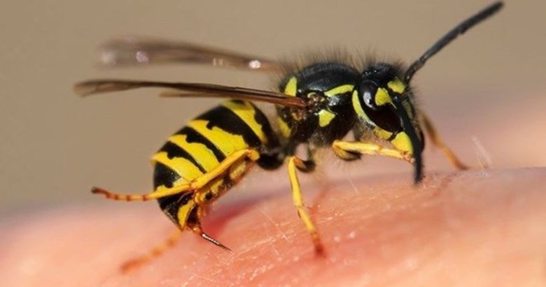Arı sokmasına ne iyi gelir? Arı sokmasında alerji belirtileri nelerdir? Nasıl tedavi edilir?