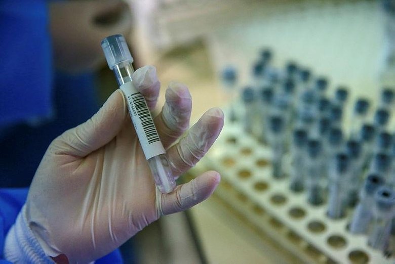 İzmir’deki PCR laboratuvarında 5 örnekten biri pozitif çıkıyor