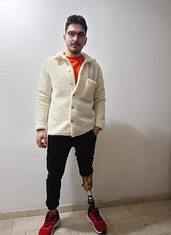 Milli Sporcu Berkay yeni protezine kavuştu