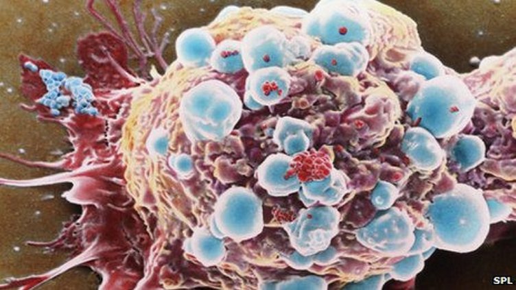 Deri hastalıklarını taklit eden kanser hücrelerine dikkat