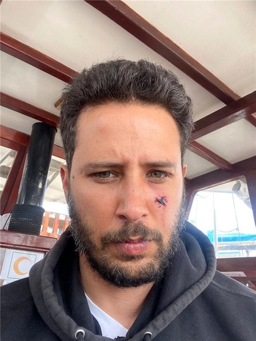 Ünlü oyuncu Tuan Tunalı köpek saldırısına uğradı