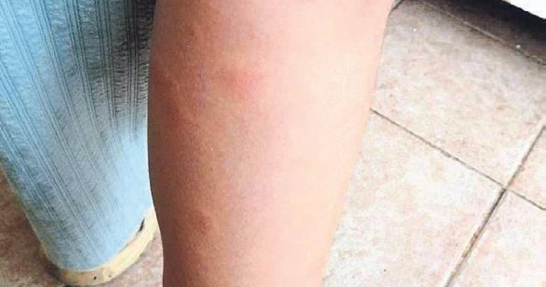 Vatandaş isyanda: Foça’yı sivrisinekler istila etti