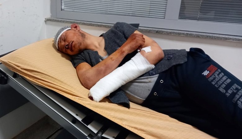 Afyonkarahisar’da çırağını saatlerce döven patron tutuklandı