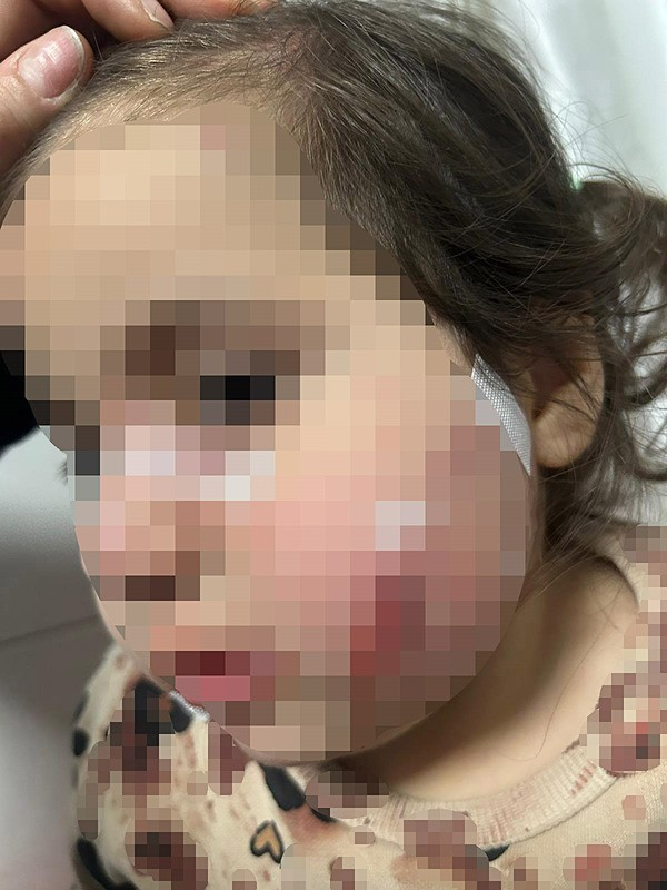 Minik Ada köpeklerin saldırısına uğradı