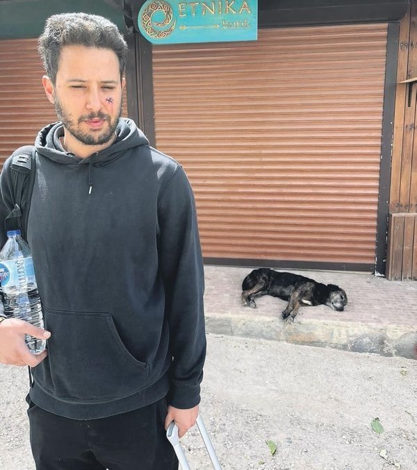 Ünlü oyuncu Tuan Tunalı köpek saldırısına uğradı